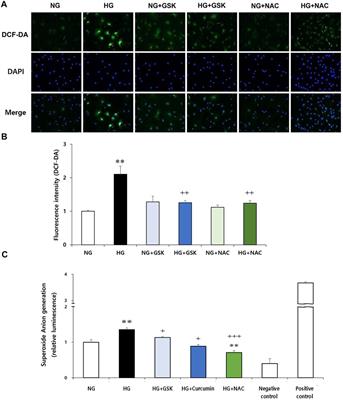 Curcumin Blocks High Glucose-Induced Podocyte Injury via RIPK3-Dependent Pathway